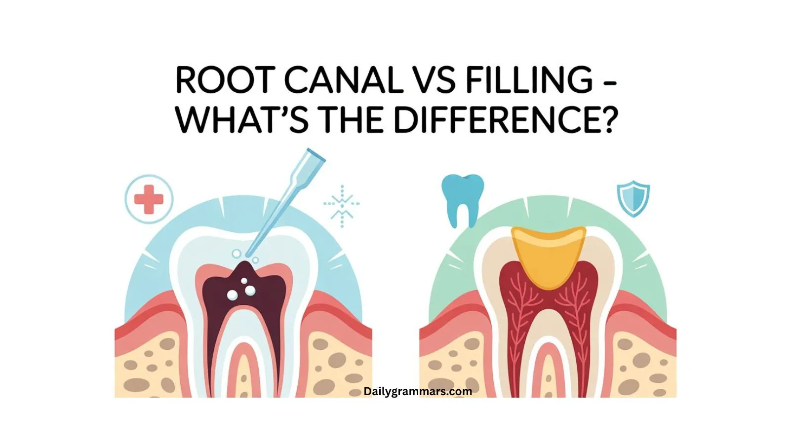 Root canal vs filling