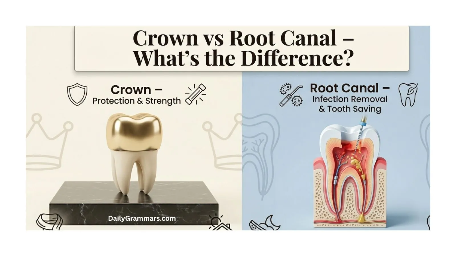 Crown vs Root Canal